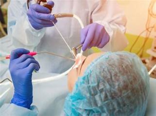 septoplasty-procedure